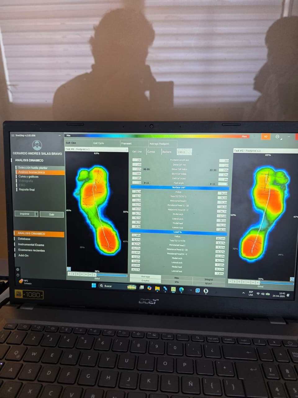 Análisis de pisada con software FreeStep