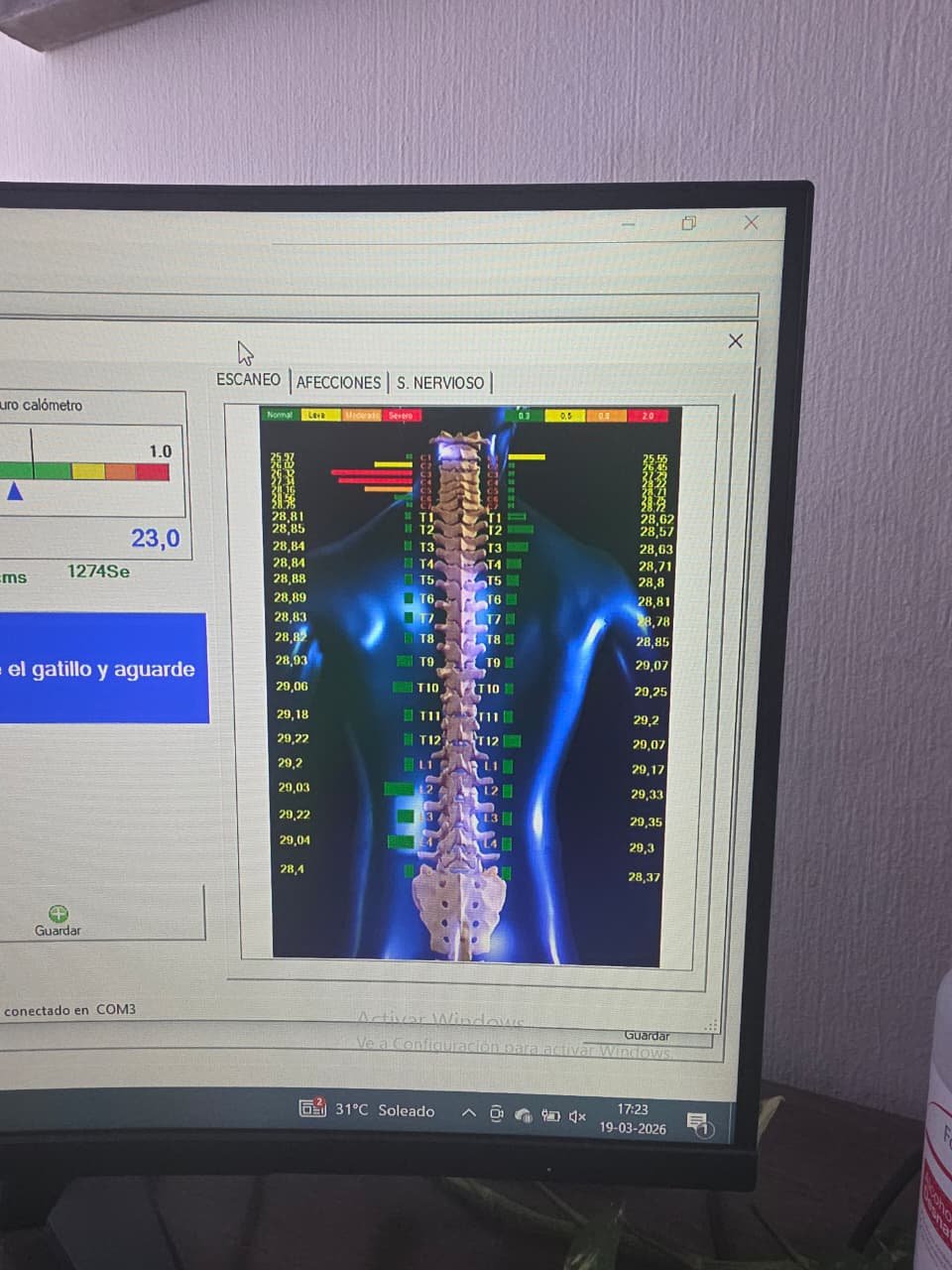 Escaneo postural de columna FootGO